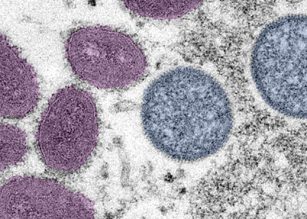 The Monkeypox Virus